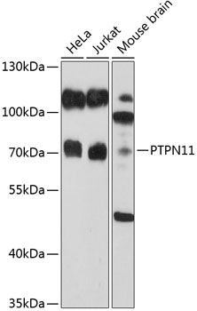 Western blot
