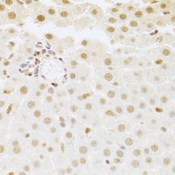 Immunohistochemistry - SFN Polyclonal Antibody (144-01026)