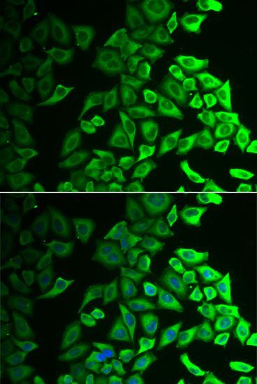 Immunofluorescence - IL18BP antibody (144-06445)