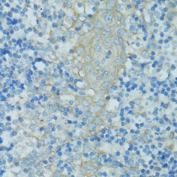 Immunohistochemistry - TJP2 Polyclonal Antibody (144-00594)