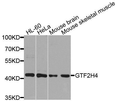 Western blot - GTF2H4 Polyclonal Antibody (144-08425)