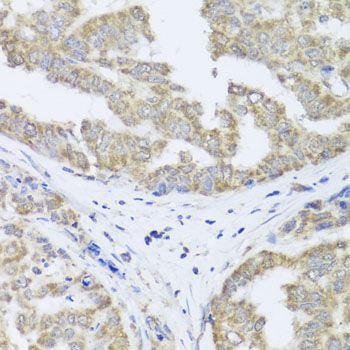 Immunohistochemistry - TIMM10B Polyclonal Antibody (144-08488)