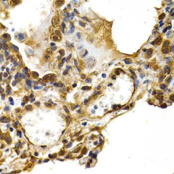 Immunohistochemistry - HSPB8 antibody (144-02514)