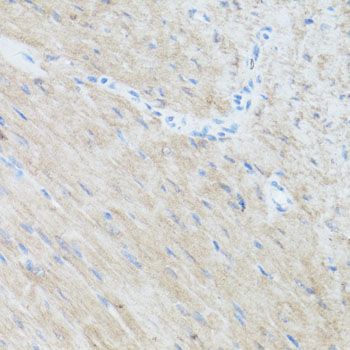 Immunohistochemistry - CLUH Polyclonal Antibody (144-010140)