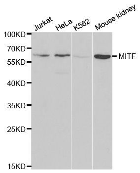 Western blot - MITF antibody (144-01255)