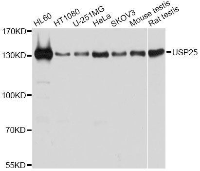 Western blot - USP25 antibody (144-12588)