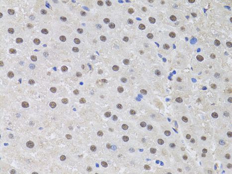 Immunohistochemistry - HUS1 antibody (144-60528)