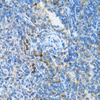 Immunohistochemistry - UBE2D1 antibody (144-01951)