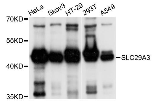 Western blot - SLC29A3 Polyclonal Antibody (144-10377)
