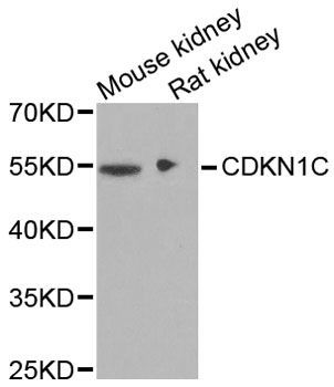 Western blot - CDKN1C antibody (144-02060)