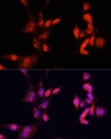 Immunofluorescence - IRAK1 antibody (144-600844)