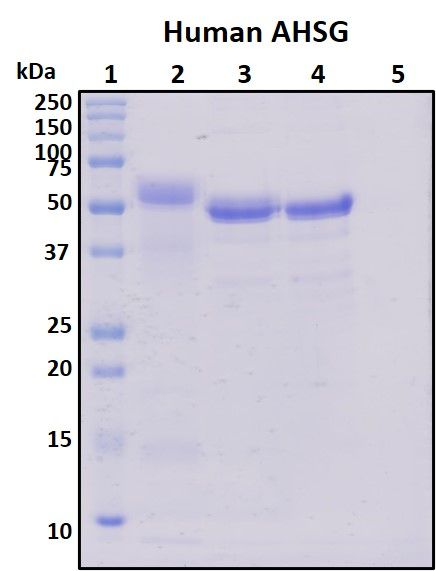 SDS-PAGE