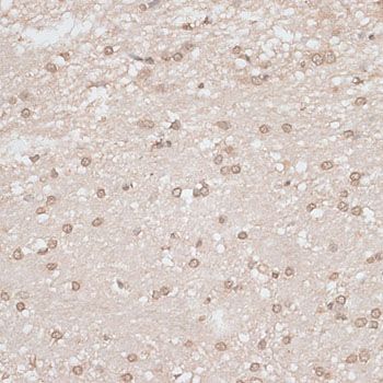 Immunohistochemistry - GPKOW antibody (144-013214)
