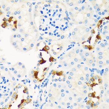 Immunohistochemistry - CPT2 antibody (144-02876)
