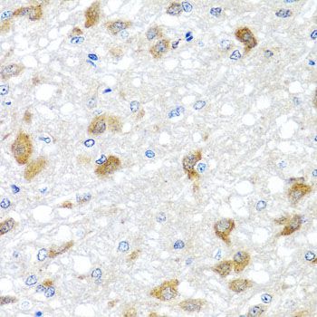 Immunohistochemistry - PIP4K2B antibody (144-08016)