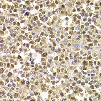 Immunohistochemistry - XRCC4 Polyclonal Antibody (144-01677)