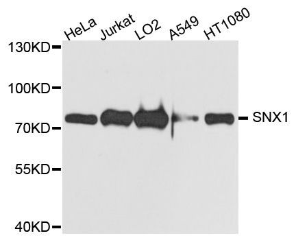 Western blot - SNX1 antibody (144-08625)