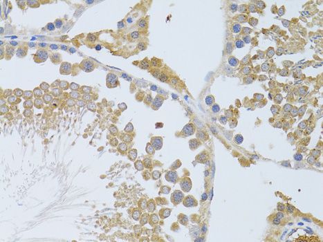 Immunohistochemistry - ATG13 Polyclonal Antibody (144-00690)
