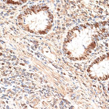 Immunohistochemistry - MCM5 antibody (144-013514)