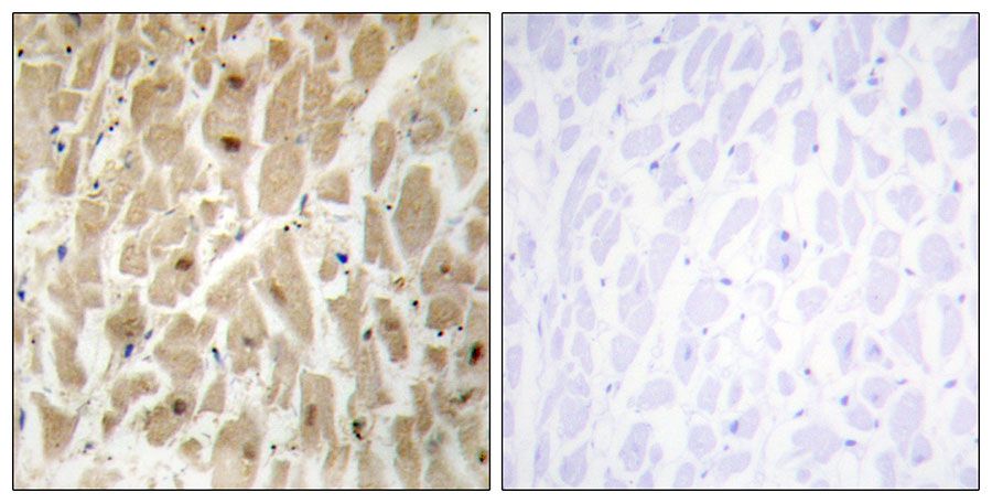 IHC