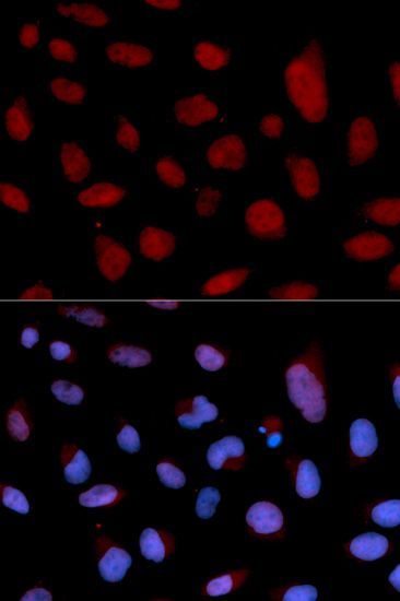 Immunofluorescence - TNNC1 antibody (144-01927)