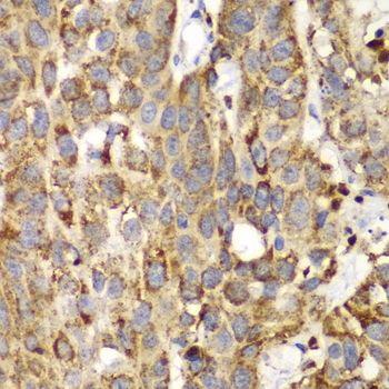 Immunohistochemistry - SHMT2 Polyclonal Antibody (144-01215)