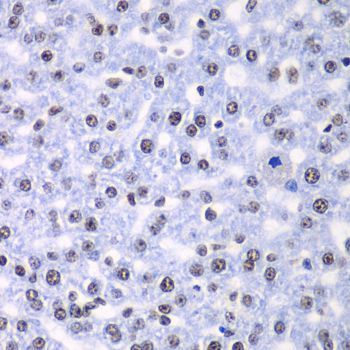 Immunohistochemistry - SF3B2 Polyclonal Antibody (144-05875)