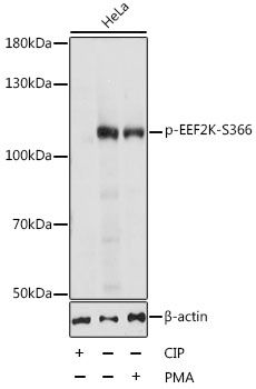 Western blot - Phospho-EEF2K-S366 antibody (144-61550)