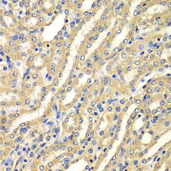 Immunohistochemistry - WIPI2 Polyclonal Antibody (144-07537)