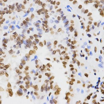 Immunohistochemistry - DiMethyl-Histone H3-K9 antibody (144-02359)