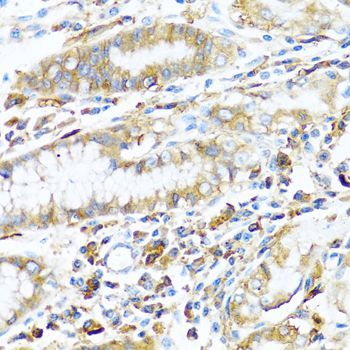 Immunohistochemistry - HLA-DPB1 Polyclonal Antibody (144-01412)
