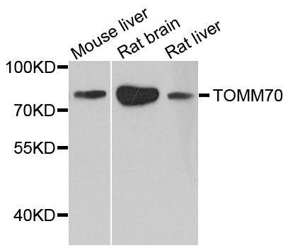 Western blot - TOM70 Polyclonal Antibody (144-04349)