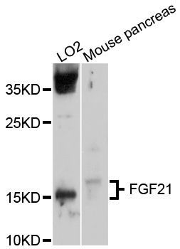 Western blot - FGF21 Polyclonal Antibody (144-10368)