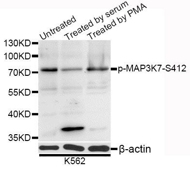 Western blot - Phospho-MAP3K7-S412 antibody (144-50071)