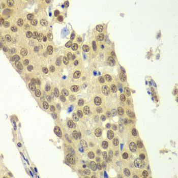 Immunohistochemistry - IKBKB antibody (144-02087)