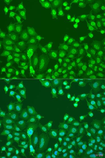 Immunofluorescence - CTCF Polyclonal Antibody (144-60257)