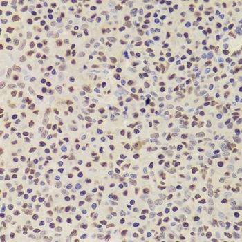 Immunohistochemistry - ANP32A Antibody (144-05768)