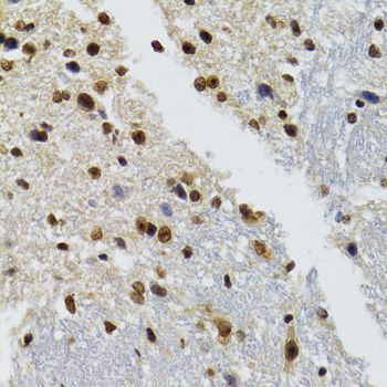 Immunohistochemistry - [KO Validated] BAZ1B Polyclonal Antibody (144-09851)
