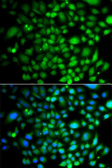 Immunofluorescence - PTK6 antibody (144-07497)