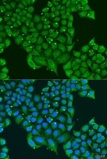 Immunofluorescence - ATPIF1 Polyclonal Antibody (144-05099)