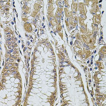 Immunohistochemistry - PDCD6IP antibody (144-02215)