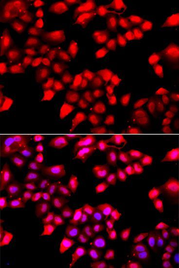 Immunohistochemistry - XRCC6 Polyclonal Antibody (144-07330)