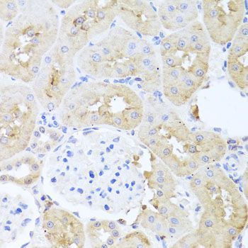 Immunohistochemistry - PDK3 antibody (144-08028)