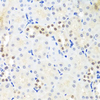 Immunohistochemistry - DDX39A antibody (144-07955)