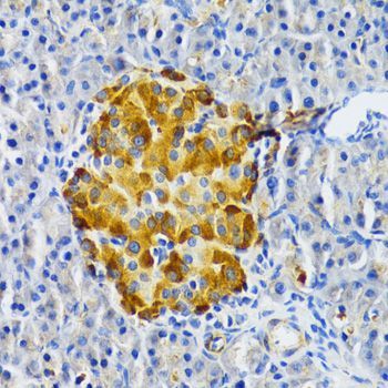 Immunohistochemistry - EDA Antibody (144-02905)