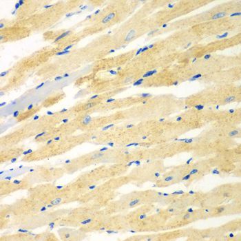 Immunohistochemistry - PDE4DIP antibody (144-07765)