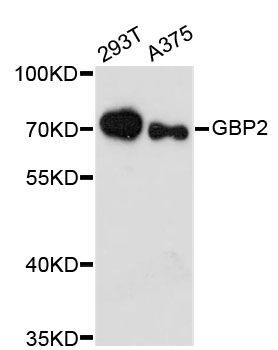 Western blot - GBP2 antibody (144-60139)