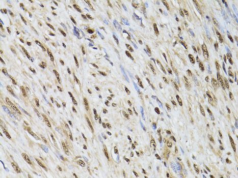 Immunohistochemistry - DCK antibody (144-01794)