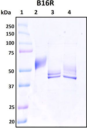 SDS-PAGE