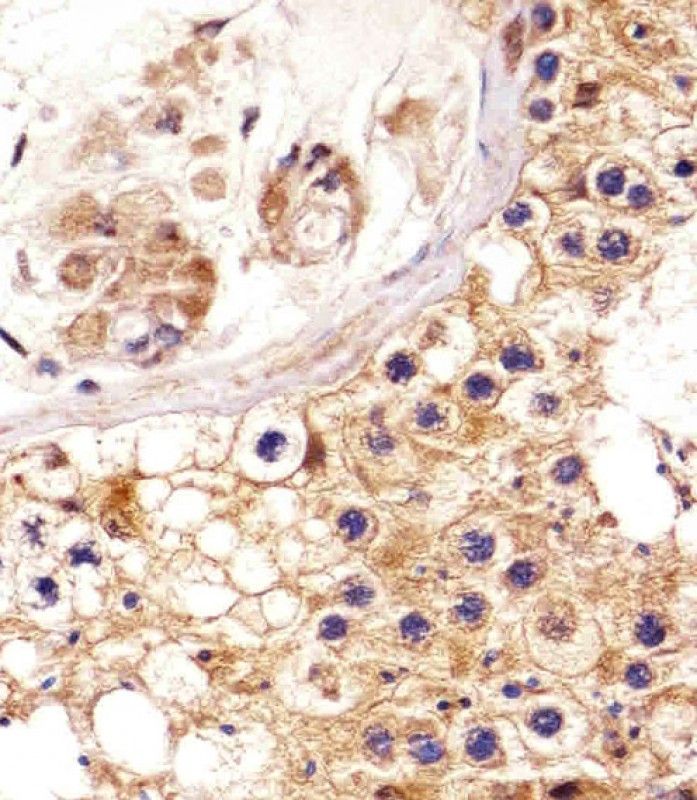 IHC-P